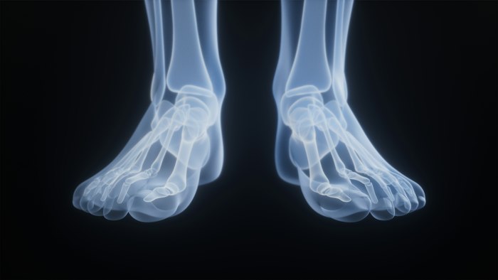 Heel, Achilles & Arch Pain foot and ankle care